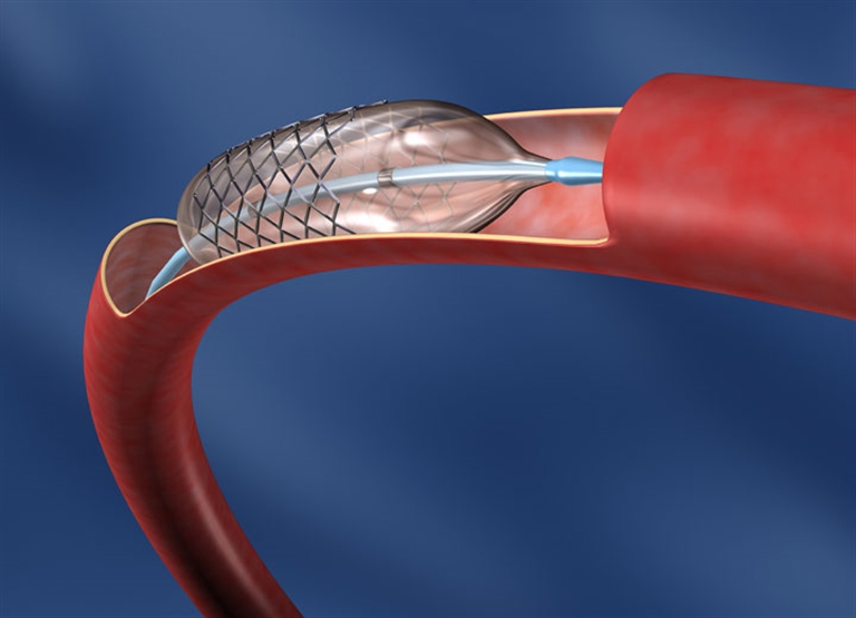 Medical device manufacturing humidification